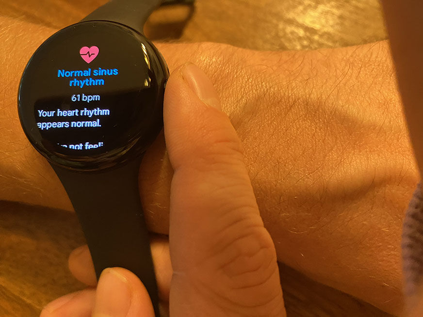 Функция ЭКГ на часах Google Pixel Watch.